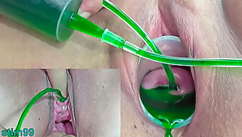 Japanese Lesbians Experiment With Extreme Gynecological Procedures For Bdsm Pleasure